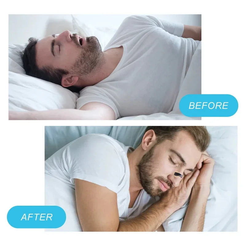 5/15/30days Magnetic Nasal Dilator Starter Kits Reduces Snoring